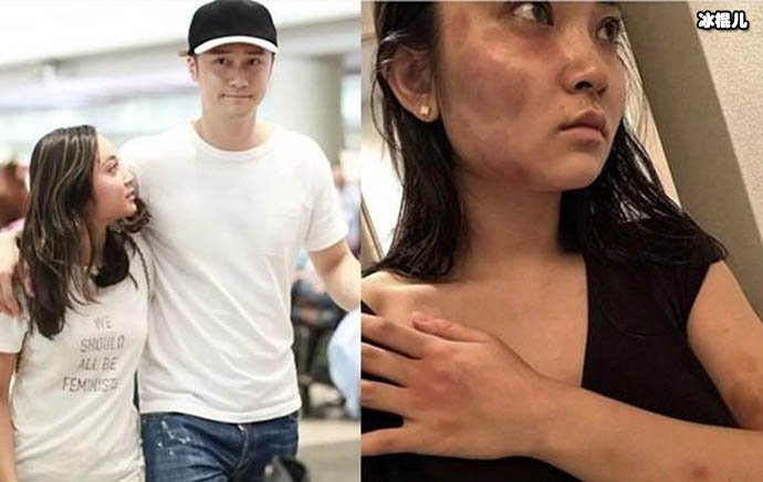 【红龙扑克】蒋劲夫大方承认恋情!蒋劲夫疑似放下之前阴霾！