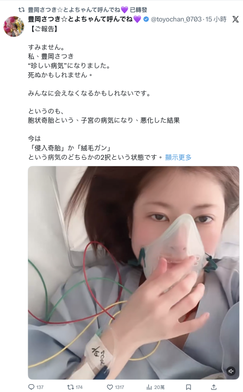 【红龙扑克】豊岡さつき(丰冈沙月)自爆罹患罕见疾病、可能致命！